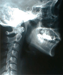 X-Ray ギャラリー