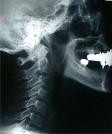 X-Ray ギャラリー