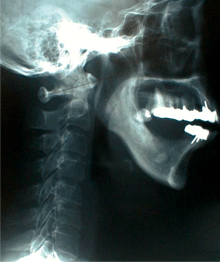 X-Ray ギャラリー